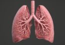 מחלת הריאות COPD